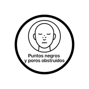 Puntos Negros