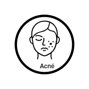 Acné